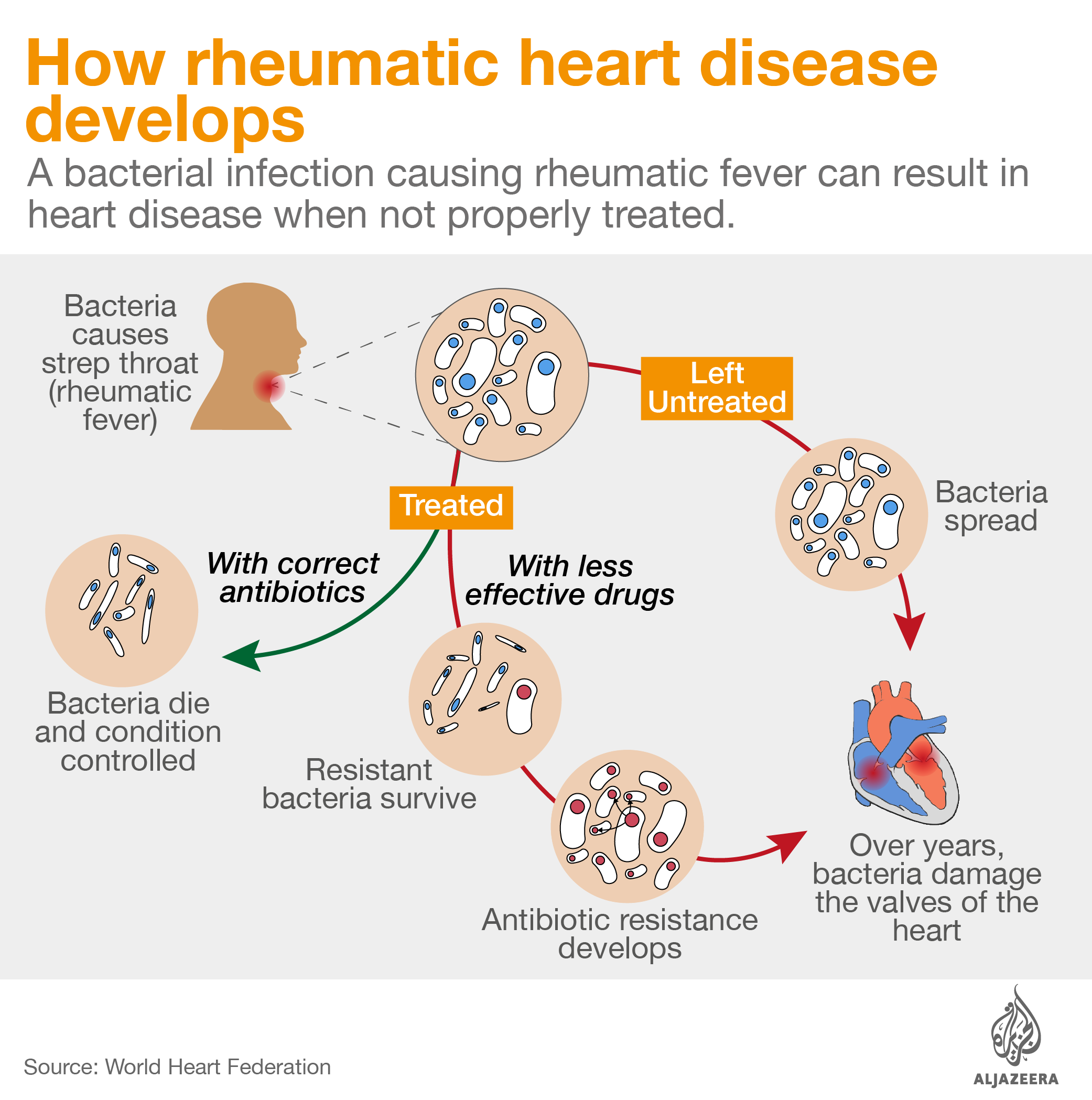 cómo se desarrolla la enfermedad cardíaca reumática