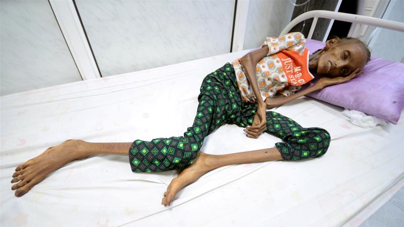 Image result for 'Millions to die' unless Saudi-led Yemen blockade ends - UN