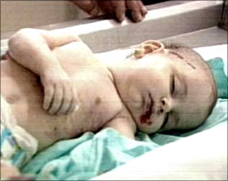 The youngest Palestinian casualty of the Intifada, five-month-old Iman Hidjou.