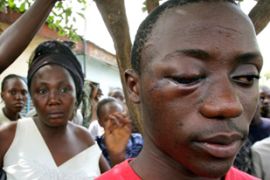 Guinea Police Beating Bruise