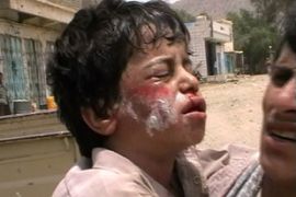 Child purportedly injured in clashes in northern Yemen