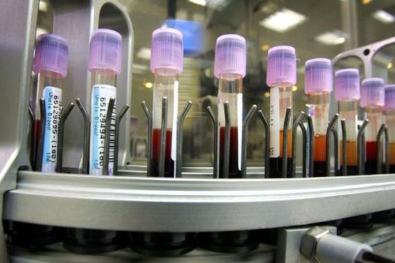 Viles of blood in Israeli laboratory