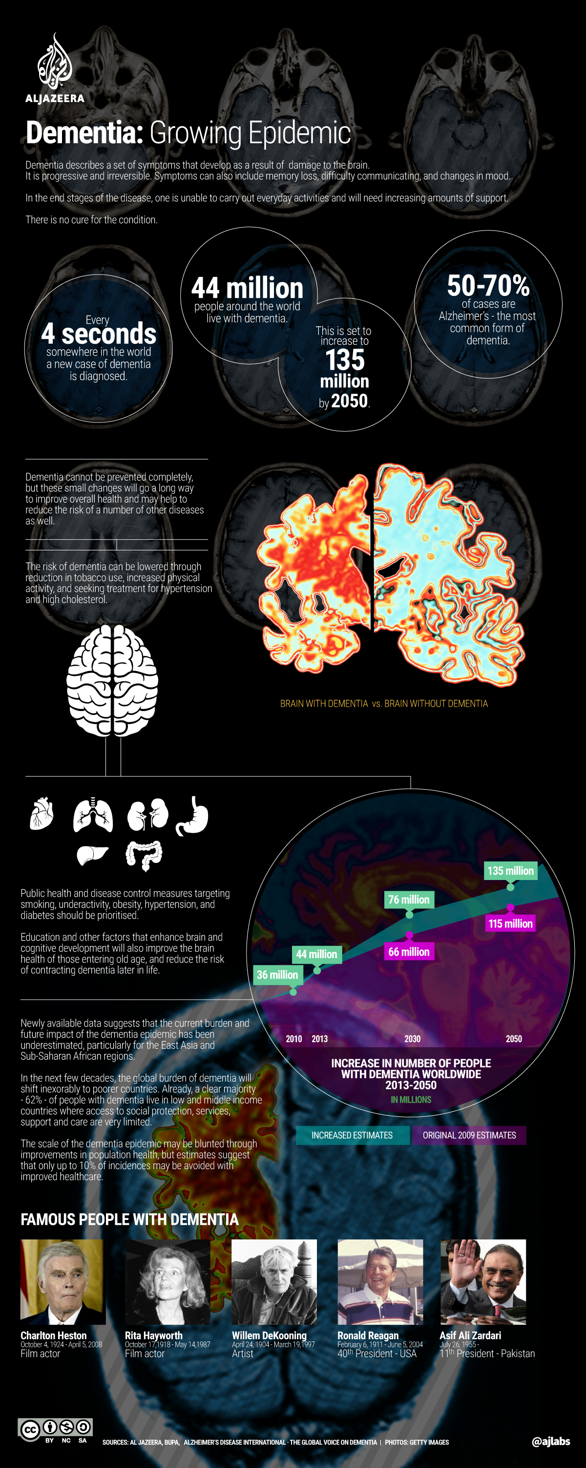 Infographic: Dementia - a growing epidemic