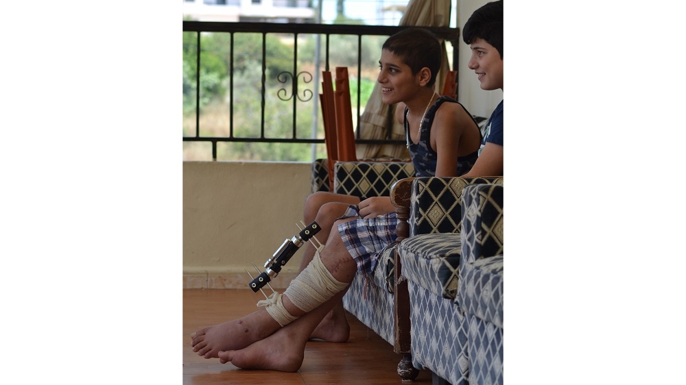 Months after the blast that wounded several members of his family, Nabih is still unable to attend school due to the metal pins in his leg [Joseph Ataman/Al Jazeera]