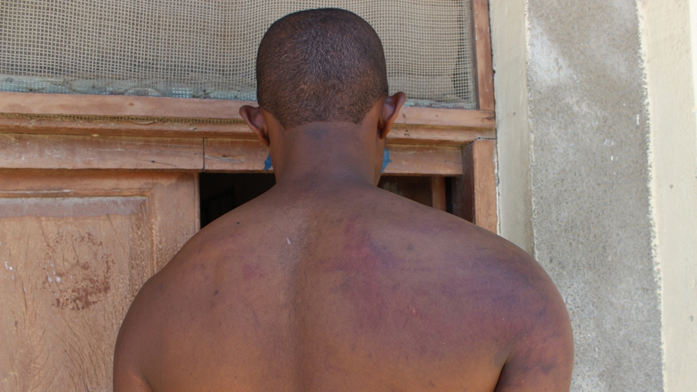 Ali Said Aziz, 29, an unemployed resident of Mwembetanga, an inner city neighbourhood in Zanzibar, alleged he was beaten by men dressed in military uniform [Tendai Marima/Al Jazeera]