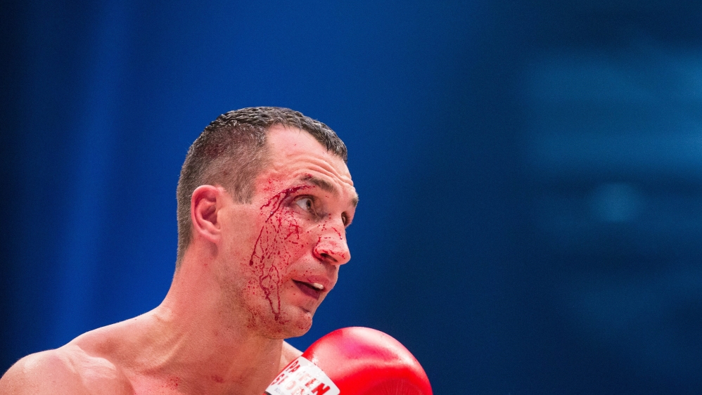 Wladimir Klitschko said he will 'definitely' use the option of a rematch, which is in the fight contract [EPA]