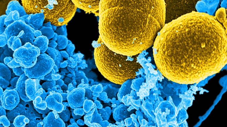 A digitally-colorized scanning electron micrograph depicts Staphylococcus aureus bacteria in the process of escaping their destruction by white blood cells in this handout photo.