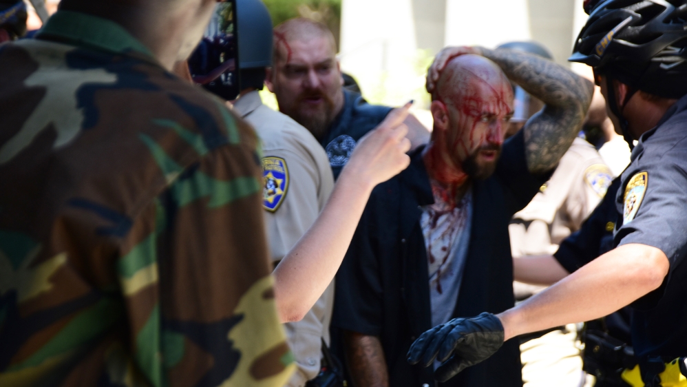 Several protesters were hospitalised after the June 2016 Sacramento riots [File: Steven Styles/Associated Press]