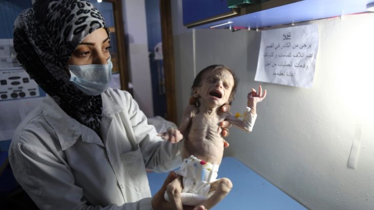 SYRIA-CONFLICT-CHILDREN-MALNUTRITION