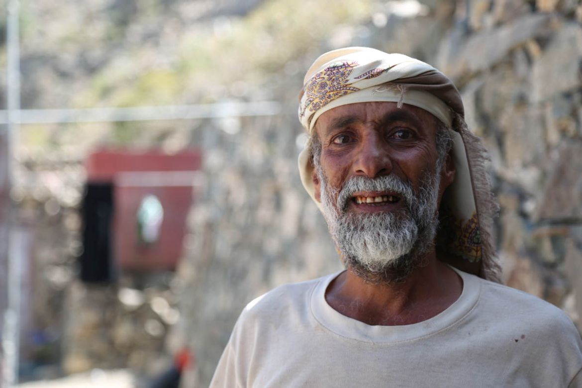 Ali Mothana Ali, 50, from Al-Dhalea, got seriously injured when his house was hit. “The airstrike that hit my house; it caught me just outside my home,” he said. “Shrapnel from the explosion hit me.