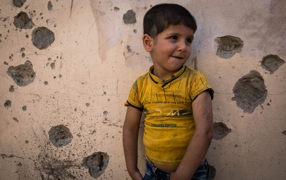 A child leans against the bullet-riddled wall of his house. Three years ago, ISIL took control of the neighbourhood and Kaiwan suffered burns to his left arm while fleeing with his family. The scars of conflict are still fresh on the child's body and the city's walls. [Tom Peyre-Costa/NRC]