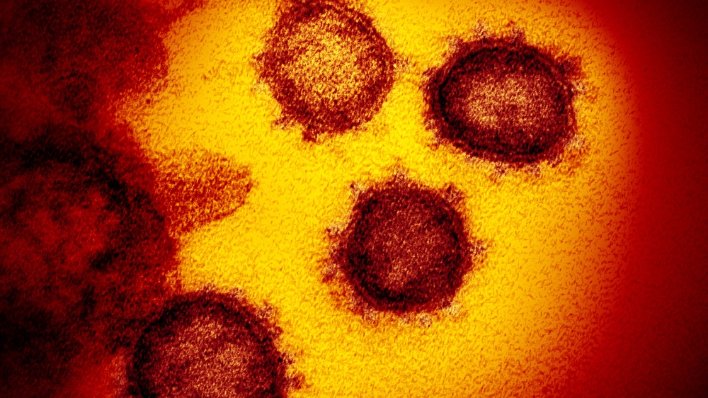 صورة بالمجهر الإلكتروني لفيروس كورونا الجديد والذي يُسبب مرض "كوفيد - 19" بعد عزله من مريض في الولايات المتحدة | عبر المعهد الوطني للصحة في الولايات المتحدة