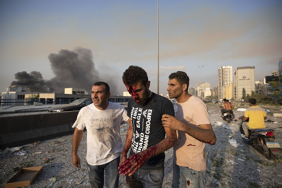 People help a man who was wounded in Beirut's massive explosion. [Hassan Ammar/AP Photo]