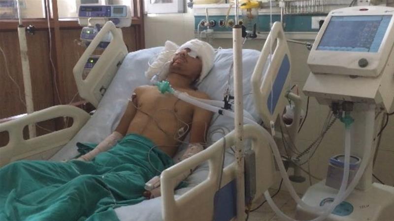 Kashmir: Civilians severely wounded in pellet gun attacks