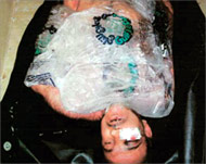 A dead prisoner's body wrappedin cellophane and packed in ice 