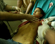 Dozens of Palestinian children have suffered serious injuries