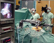 Surgeons now use robots to carryout cross-continent operations