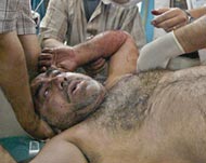 This Iraqi civilian was wounded by the Airport Road bomb