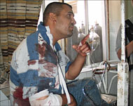 Survivors of the Hawijah bombingwere treated in a nearby hospital