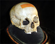 The skull was taken off display as it was considered indecent