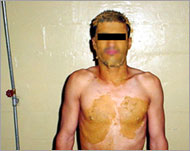 This photo shows a prisoner covered in faeces (SBS)