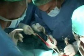 europe pioneering organ transplant youtube