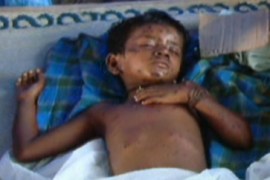Sri Lanka conflict - footage of wounded