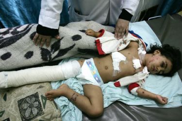 Palestinian child, injured during an israeli air raid