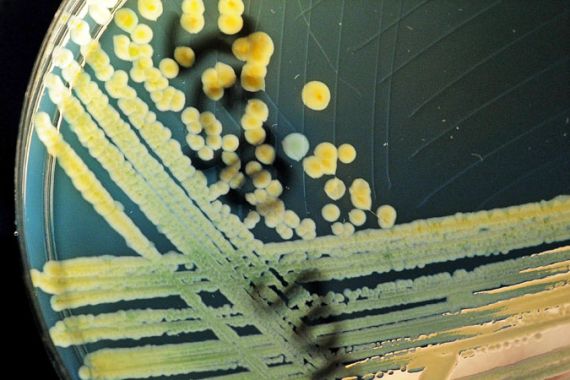 E.coli bacteria strain