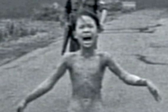 Napalm survivor Vietnam War 1970s