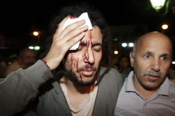 A protester bleeds during a demonstration against a royal pardon for a Spanish paedophile, in Rabat