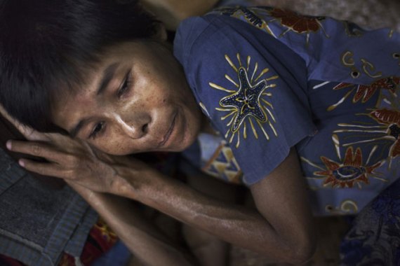 A woman with HIV in Myanmar [Lauren DeCicca/Al Jazeera]