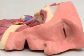 Australia 3D printing body parts