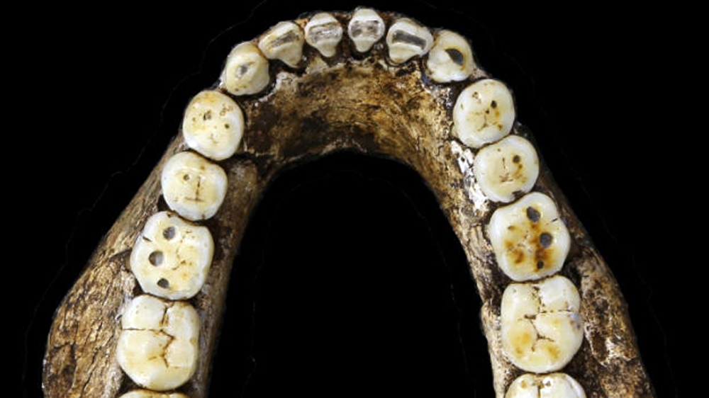 A jaw bone fragment belonging to Homo naledi [University of Witwatersrand]