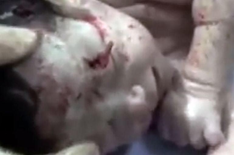 Baby born with shrapnel in head in Aleppo