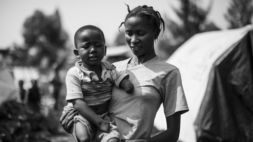 Patrick, who was born without hands and feet, is held by his mother in the Mugunga III IDP camp in Goma [Alberto Rojas/Al Jazeera] 