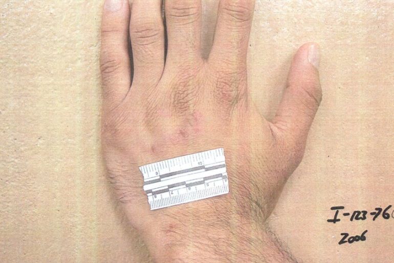 A measurement strip lies on the hand of a detainee in an undated photo from Iraq''s Abu Ghraib prison
