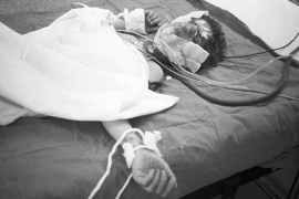 A young boy victim of Saddam Hussein's chemical gas attack on Halabja, lies in a Tehran hospital bed, March 1988. [Getty]