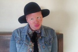 World Albinism Day