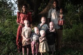 DO NOT USE! Albinism - Fredrik Lerneryd