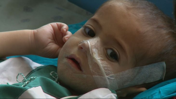 Afghan child in Mirwais hospital in Kandahar