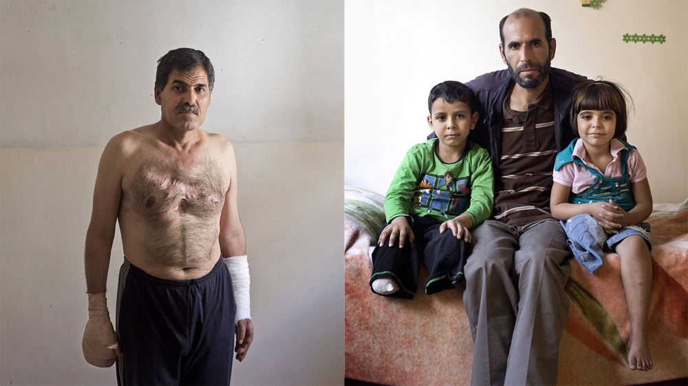 LEFT: Achmed, 53, from Deraa, was injured while on his way home after Friday prayers. He was injured in the chest and lost two fingers. RIGHT: Six-year-old Jumna, right, and Aid, 8, left, from Tel al-Shaab in Deraa province. Their father, Mohammed Aid Muqbil, 40, centre, is an agricultural worker. When a helicopter dropped four barrel bombs over their town, one exploded above their house. Their mother Fatima, 35, was killed, as was their paternal uncle, Abed. Their father was injured in the hip, Jumna lost one lower leg, and Aid lost both. [Courtesy of Kai Wiedenhofer]