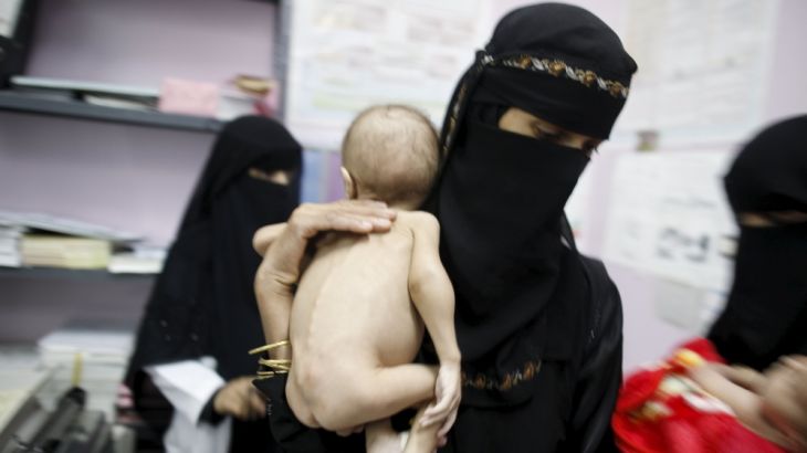 A woman holds her malnourished child at a malnutrition intensive care unit in Yemen''s capital Sanaa