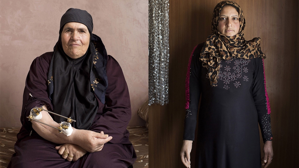 LEFT: Raya, 63, from Basr al-Harir in Deraa province, was injured by an artillery grenade shortly before evening prayers. She received shrapnel in her face, legs and her arm was shattered. RIGHT: Naghme H, 24, is from a Bedouin tribe and was working in a jam factory in the Syrian army-beseiged village of Meliha in the outskirts of Damascus. She was injured when a plane dropped a bomb on the factory. [Courtesy of Kai Wiedenhoefer]