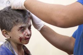 A Syrian boy receives treatment at a make-shift hospital following air strikes on rebel-held eastern areas of Aleppo