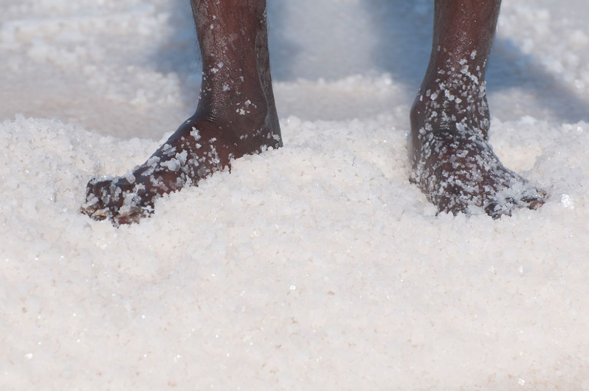In summer, the temperature is unbearably hot and the salt farmers have to work barefoot, exposing their legs to highly saturated salt. The harvesters earn a paltry sum of 60 Indian rupees per tonne ($