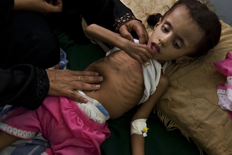 Malnutrition -Yemen