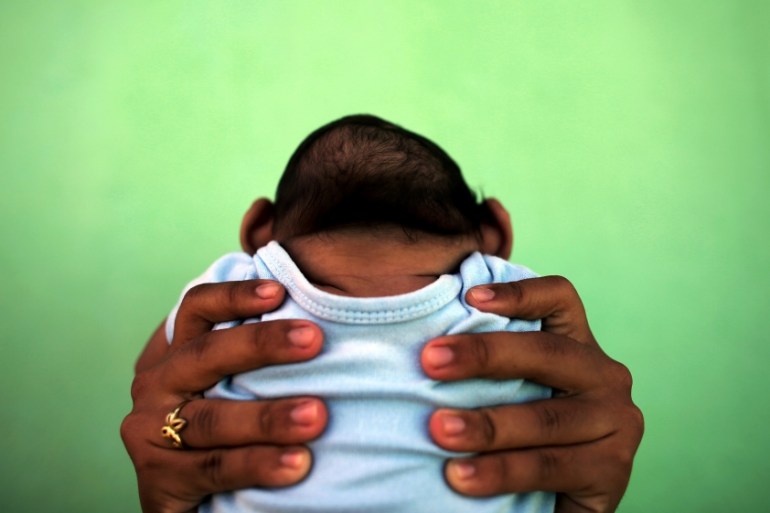 A 4-month-old baby born with microcephaly is held by his mother in front of their house in Olinda