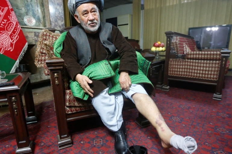 Ahmad Ishchi, who is reported to have been beaten and detained by AfghanistanÕs vice president Abdul Rashid Dostum last month, displays an injury on his leg during an interview at his home in Kabul