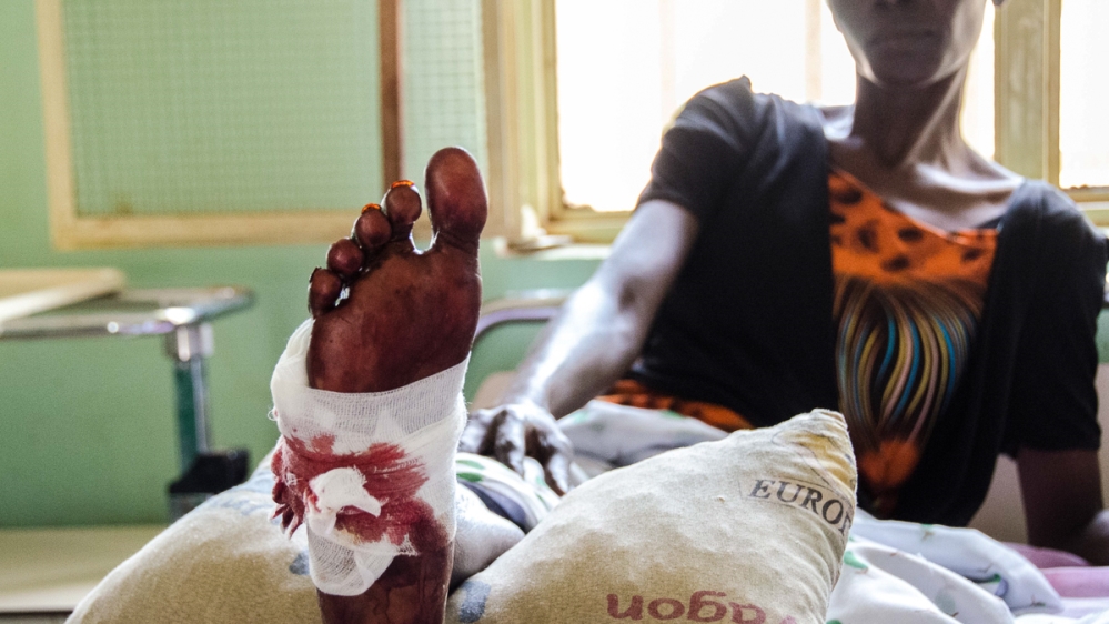 Fatna Jol Magas, a 31-year-old single mother of six, at Daniel Comboni Catholic hospital in Wau. She was shot in the street by government soldiers 10 days after the attacks. [Richard Nield/Al Jazeera]